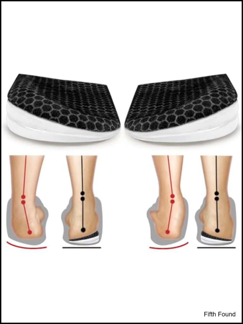 Corrective Insoles for Supination Over-Pronation Heel Wedge Foot Alignment